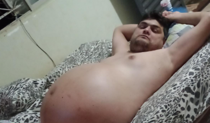 Cirurgia,transplante do figado