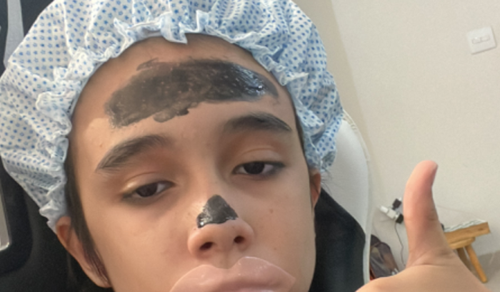 Investimento em equipamentos kenon e duda