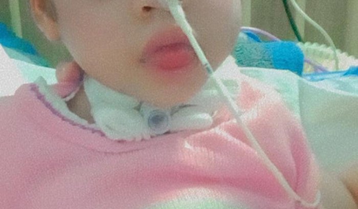 Bomba de infusão alimentar para Ester