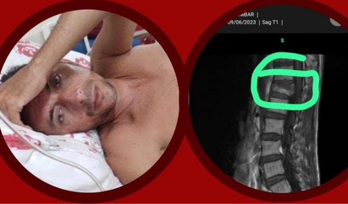 Vaquinha solidária em prol da cirurgia de coluna de Rosivan Canto