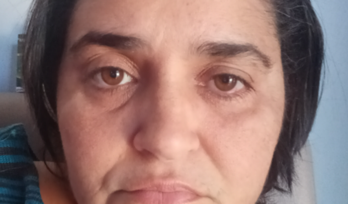 Bom dia eu e meus filhos somos doentes é uma doença genética ipex like o meu x é doente quero fazer bolo pra vender