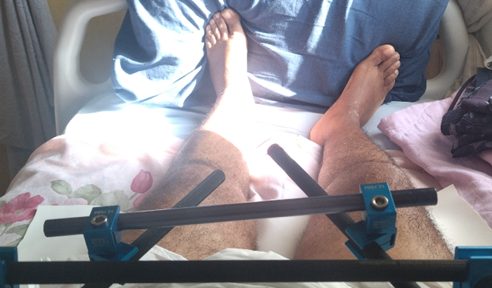 Ajuda para tratamento e vuidadosy