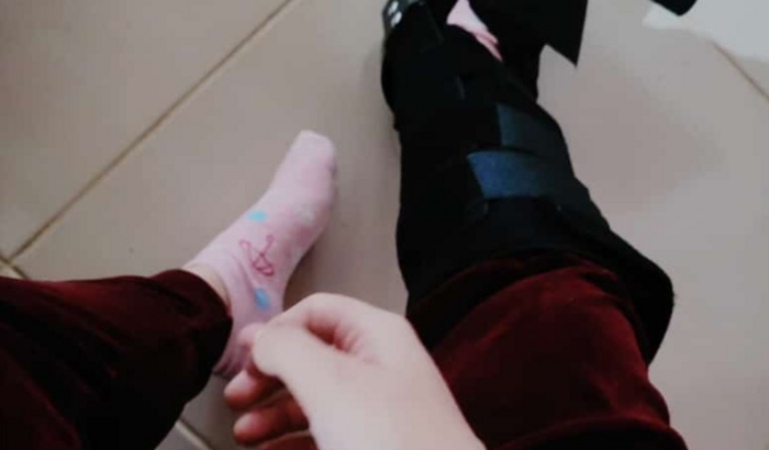 Ajuda para uma cirurgia urgente no tornozelo