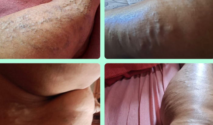 Ajuda para recuperar minha saúde!