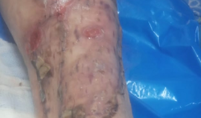 Ajuda pela recuperação do Darcio