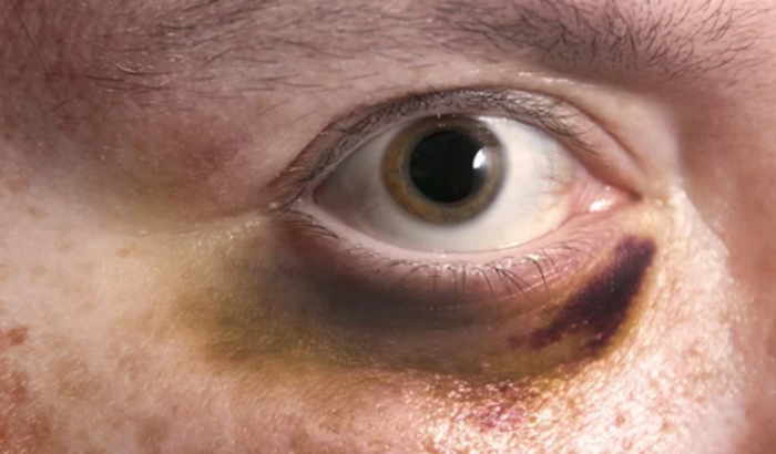 Fui roubado / tenho que retirar documentos e muita coisa 