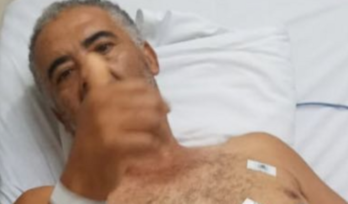 Colocar a prótese sua pernas