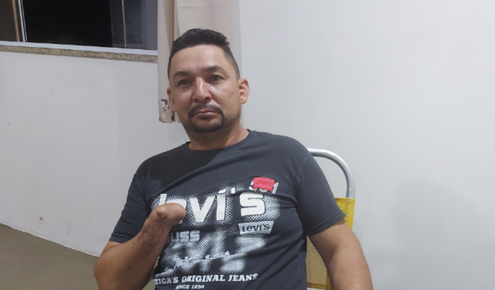 Uma prótese para Ubiraci