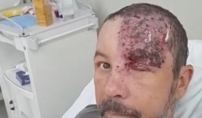 Ajuda para Exame - Tomografia