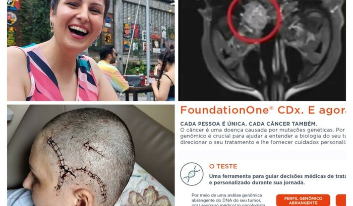 Exame  Faundation para câncer raro pra Sandra