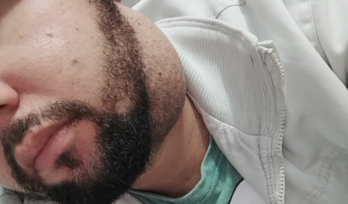 Cirurgia Cisto Branquial pescoço do Régis