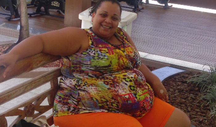 Exames e cirurgia bariátrica