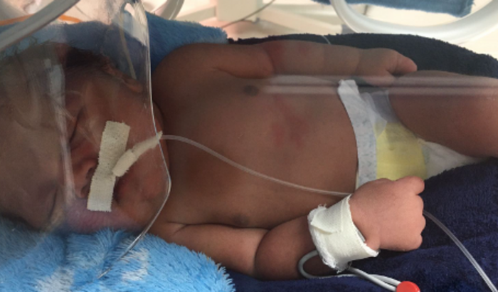 Uma ação entre amigos para ajudar a pagar a UTI NEONATAL do ISAAC RAFAEL