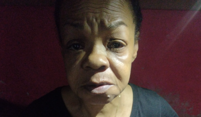 Biópsia pulmonar (suspeita maligna)