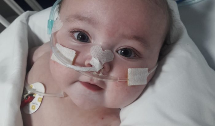 Fisioterapia respiratória