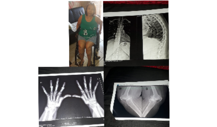 Reescrevendo Destinos: Sua Ajuda na Jornada de Sônia"