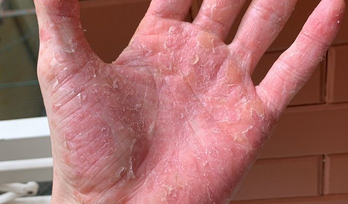 Ajuda emergencial pra trazer o Miguel pro brasil pra fazer tratamento do HIV