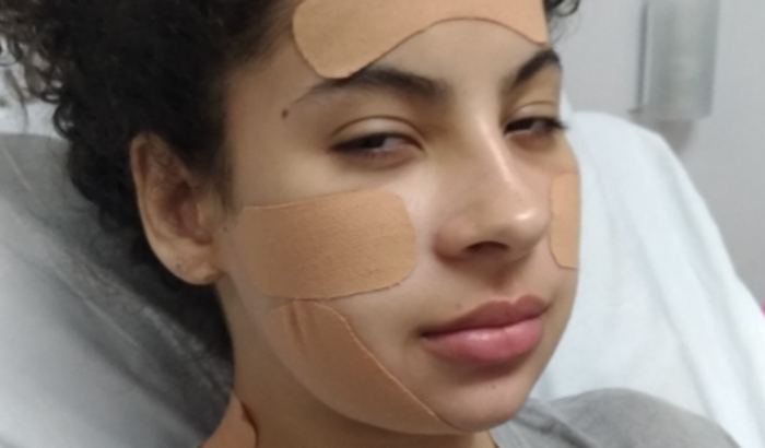 Ajude a Julia! Ela necessita fazer uma intervenção cirúrgica