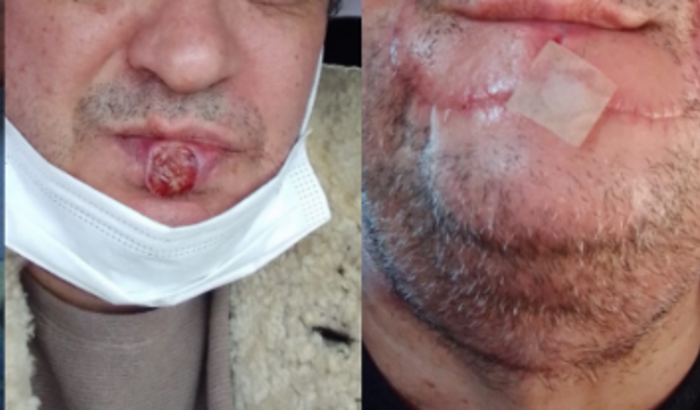 Tratamento de Saúde Cantor Jovani Lemos