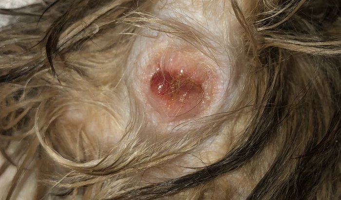 TRATAMENTO E CIRURGIA DO PUDIM