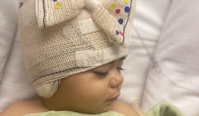 Ajude Helena nesta segunda cirurgia de revascularização cerebral!