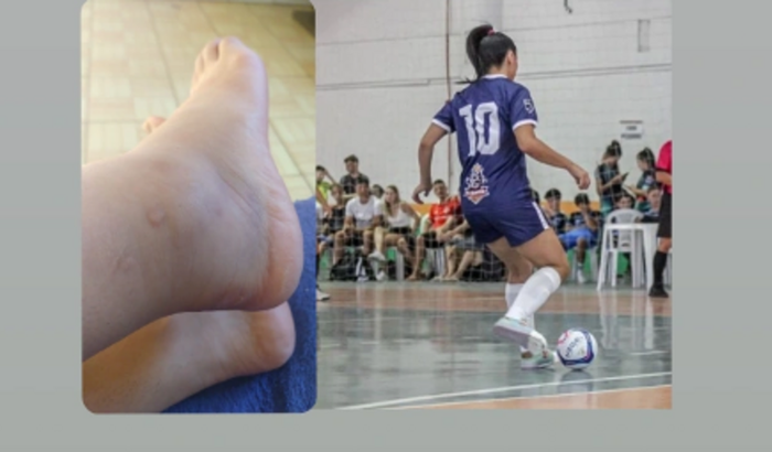 Para ajuda de custos na realização de uma ressonância e fisioterapias para lesão no tornozelo 