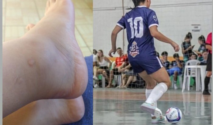 Para ajuda de custos para uma ressonância magnética e fisioterapias para lesão no tornozelo.