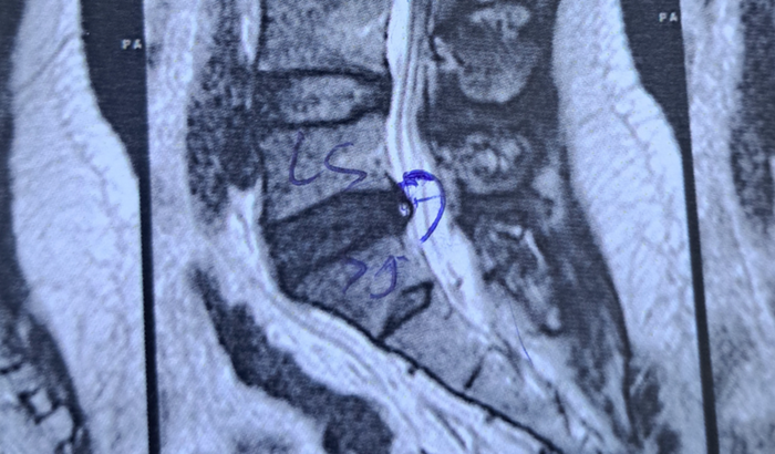 Ajude na Operação Dançarino 