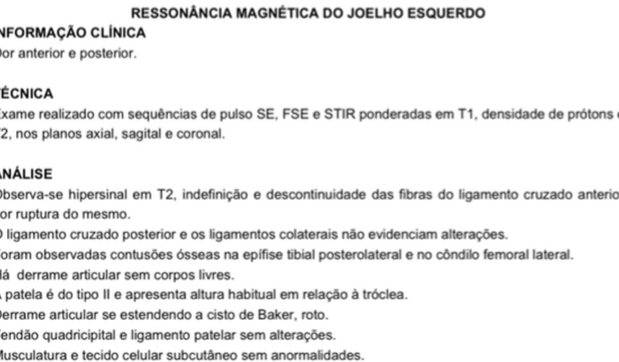 Cirurgia do ligamento cruzado Gabriel Campos