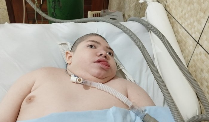 Jeferson precisa de um respirador portátil (BIPAP)