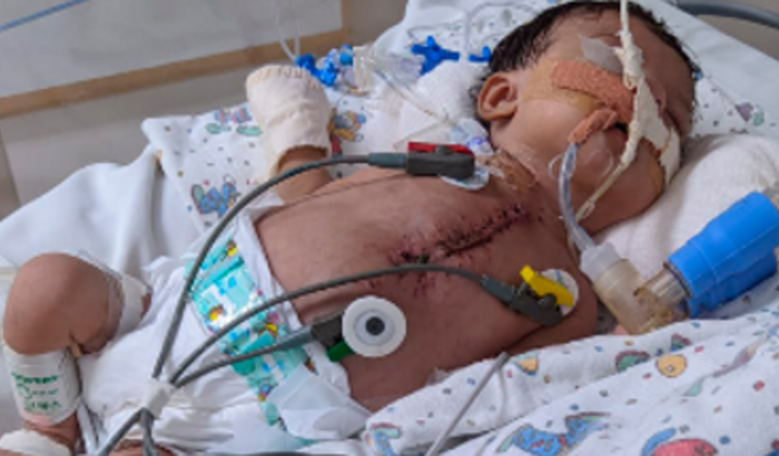 Necessidades da Alis com Síndrome de Wolf Hirschhorn