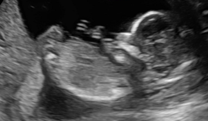 Chá de fraldas do Dante