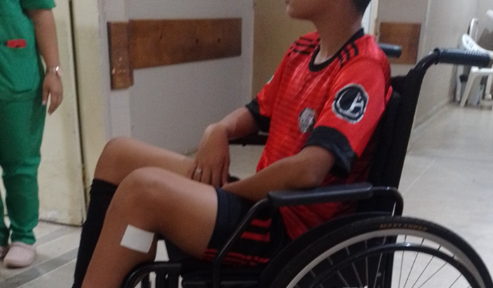 Cirurgia de joelho de jhonathan