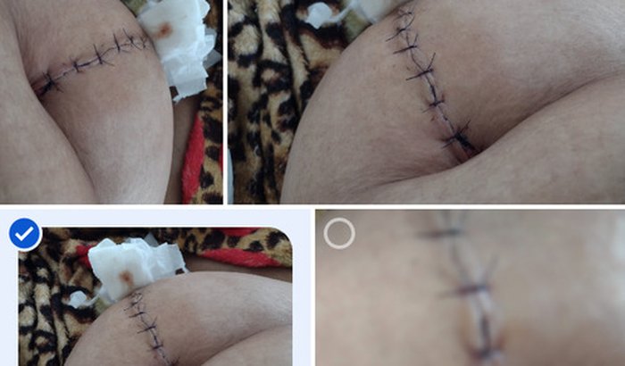 S.O.S  TRATAMENTO DO CÂNCER PRECISO CUIDA DOS MEUS FILHOS E UM LAR FIXO PRA MORAR 