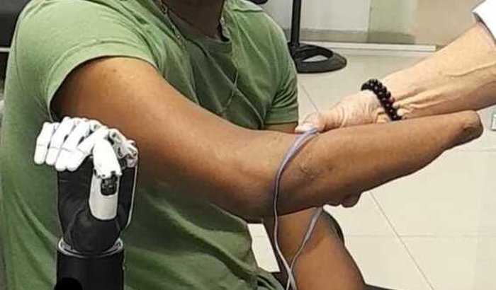 Prótese Mioelétrica para o Natã