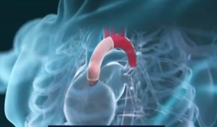 Vakinha para consertar o coração da prof Silvinha