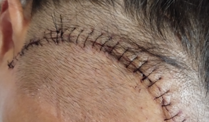 Vaquinha para pagar uma promessa de um milagre em minha vida ☺️