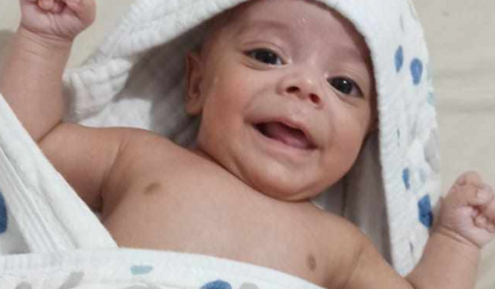 Bebe alérgico a Lactose 