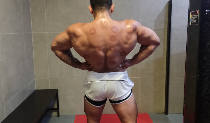 SOBRAL BATTLE champion 🏆