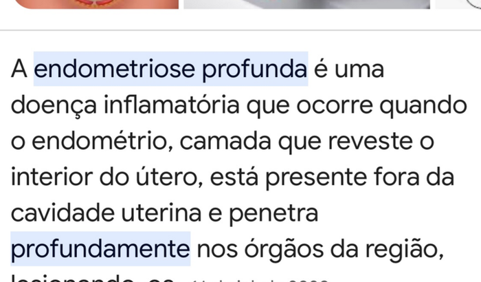 Pós cirurgia retirada endometriose 🎗️