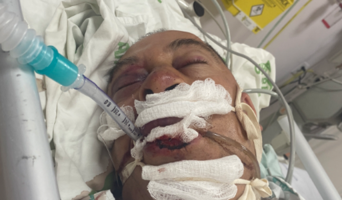 Ajuda para Dari oliveira