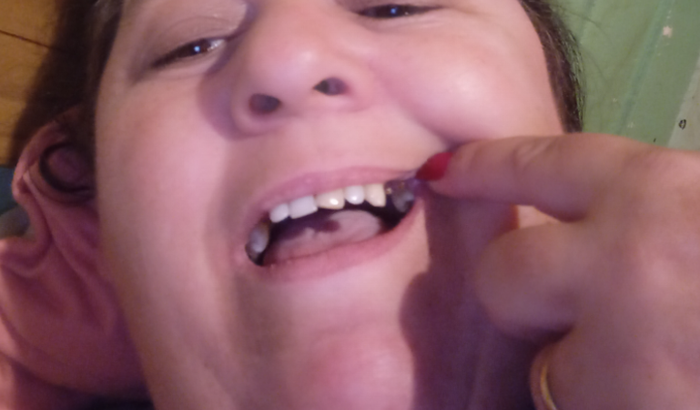 Ajuda pra arrumar meus dentes