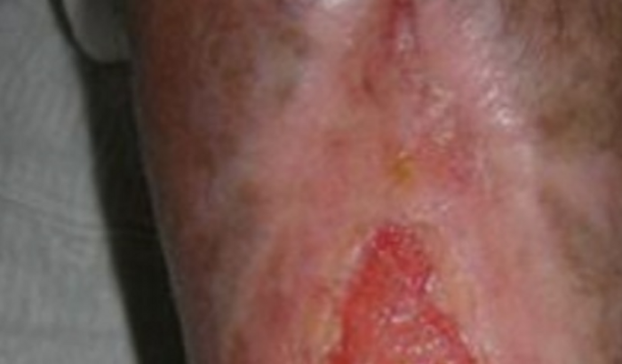 Preciso de ajuda para fazer meu tratamento