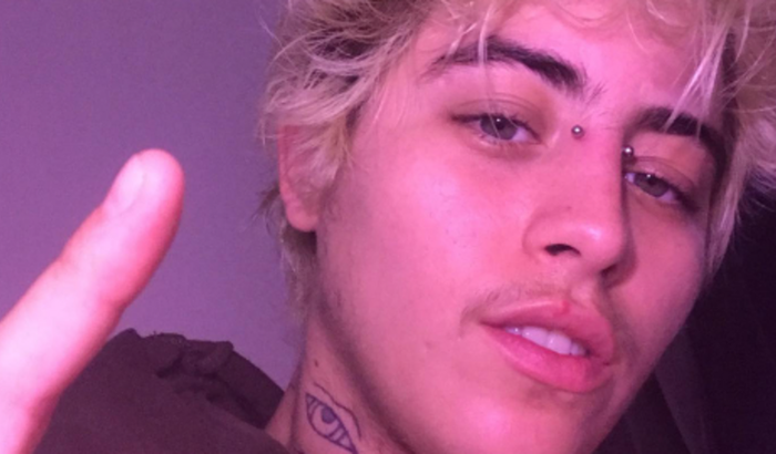 Mastectomia do Franz