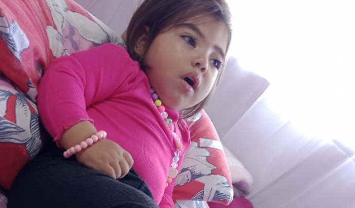 Tomografia Específica Do Ouvido