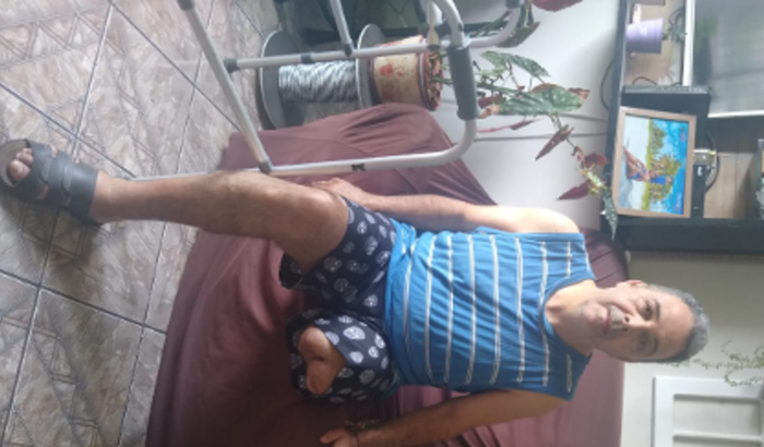 Ajudar pra comprar perna mecânica e pagar dívidas