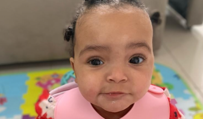 CIRURGIA CRANIOPLASTIA - MAITÊ