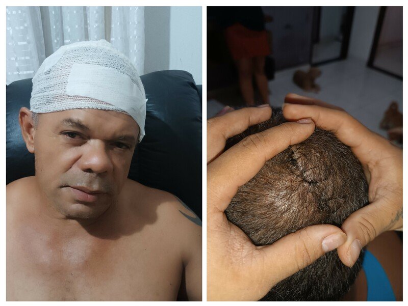 imagem da vaquinha Ajude o Josinaldo ele está com câncer (mestastase)