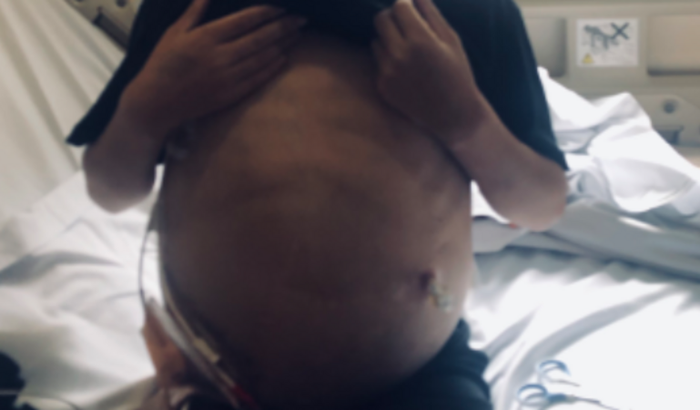 Tamsplante de intestino do Gabriel