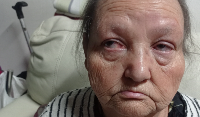 CIRURGIA DA CATARATA - MARIA ROCHA